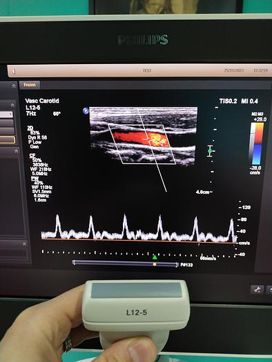 Gebraucht Ultraschallgerät Philips EPIQ 5