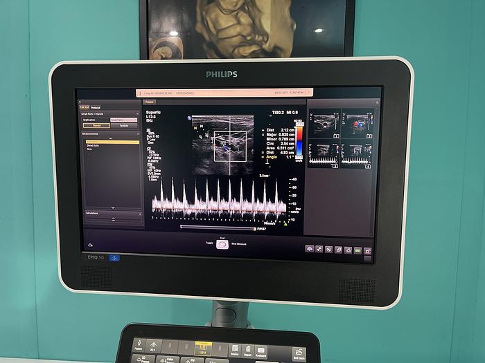 Gebraucht Philips EPIQ 5G Ultraschallgerät 