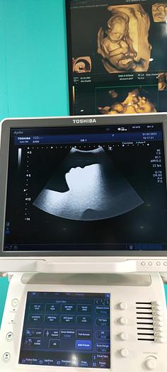 Gebraucht Toshiba Aplio 500 Ultraschallgerät mit 3 Sonden