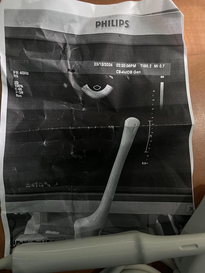 Gebraucht Philips C8-4v Endovaginal Ultraschallsonde