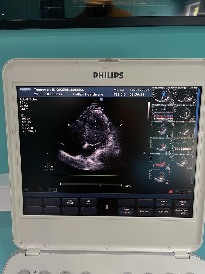Gebraucht Philips CX50 Ultraschallgerät mit S5-1 Kardiosonde