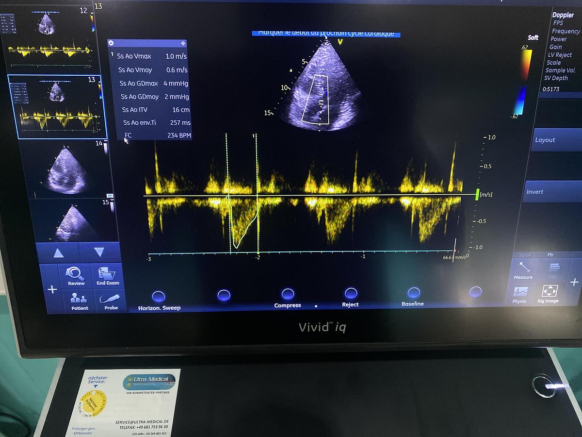 Gebraucht GE Vivid iq Ultraschallgerät mit M5Sc-RS Kardiosonde