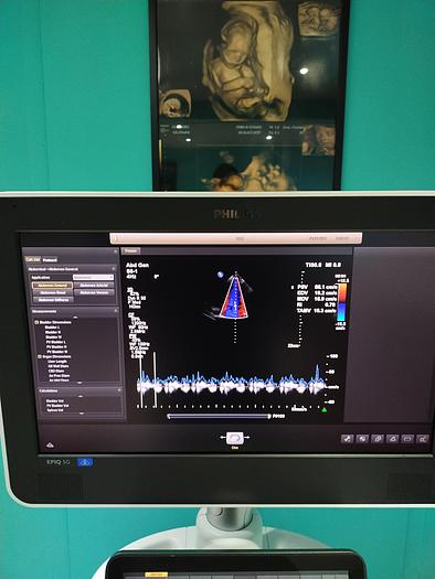 Gebraucht Ultraschallgerät Philips EPIQ 5
