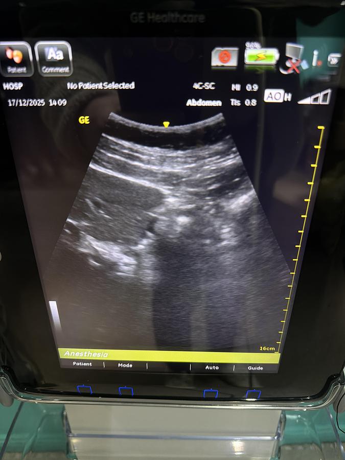 Gebraucht GE Venue 40 Ultraschallgerät mit Konvex Sonde