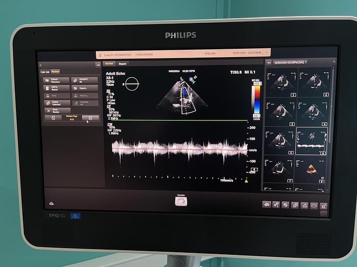 Used Philips X5-1 Sektor Ultraschallsonde