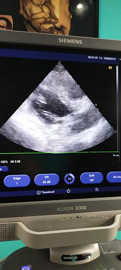 Gebraucht Siemens Acuson X300 Ultraschallgerät mit 3 Sonden