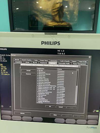 Gebraucht Philips CX50 Ultraschallgerät HW C.0 mit Sektor Sonde