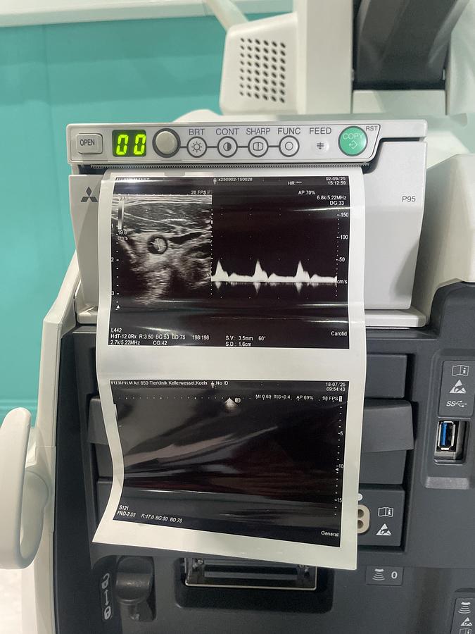 Gebraucht Hitachi ALOKA Arietta 850 Ultraschallgerät mit zwei Sonden und Drucker