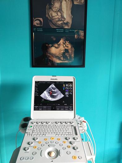 Gebraucht Philips CX50 Ultrasound with S5-1 and Trolly