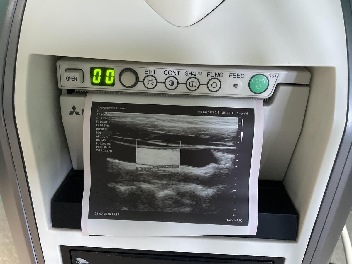 Gebraucht VINNO G55 Ultraschallgerät mit zwei Sonden und Drucker