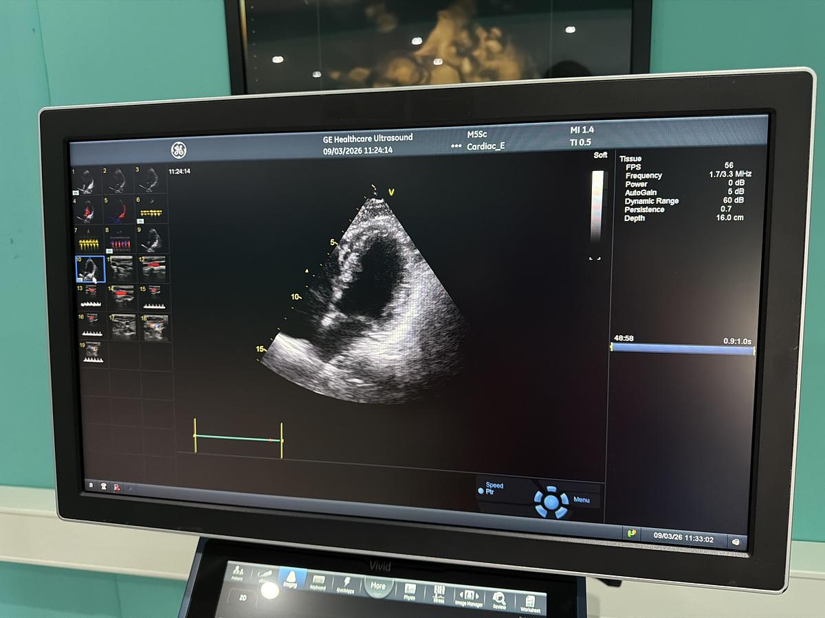 Gebraucht GE Vivid S70N Ultrasound 