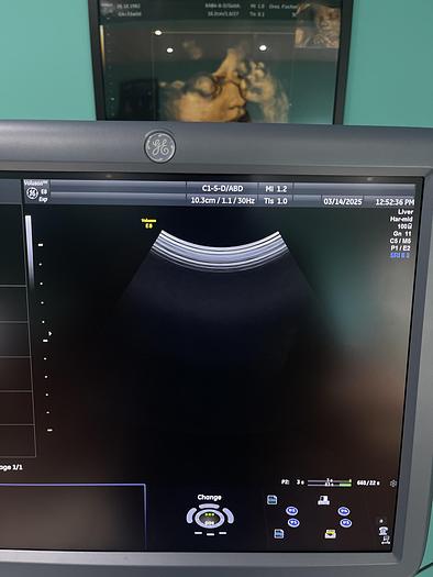 Gebraucht GE C1-5-D Konvex Ultraschallsonde 