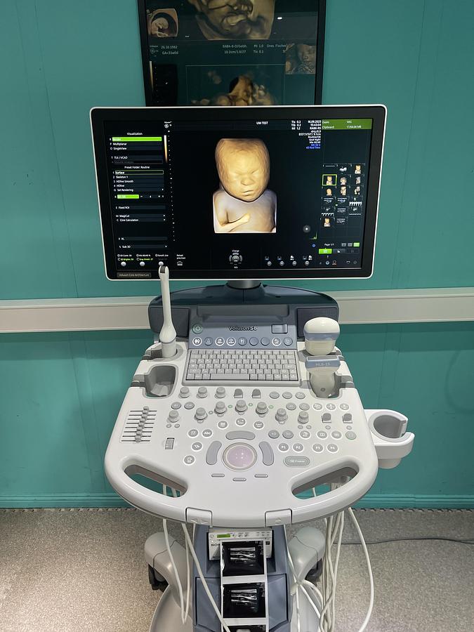 Gebraucht GE Voluson S8 Ultraschallgerät mit drei Sonden und Drucker