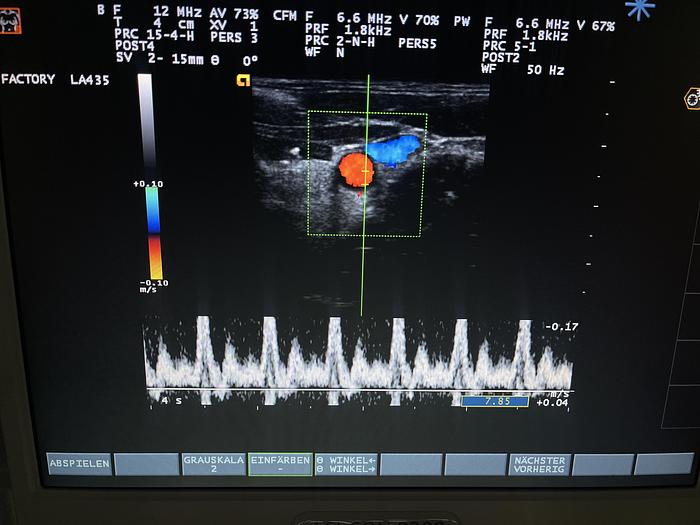 Used Esaote LA435 Ultraschallsonde 