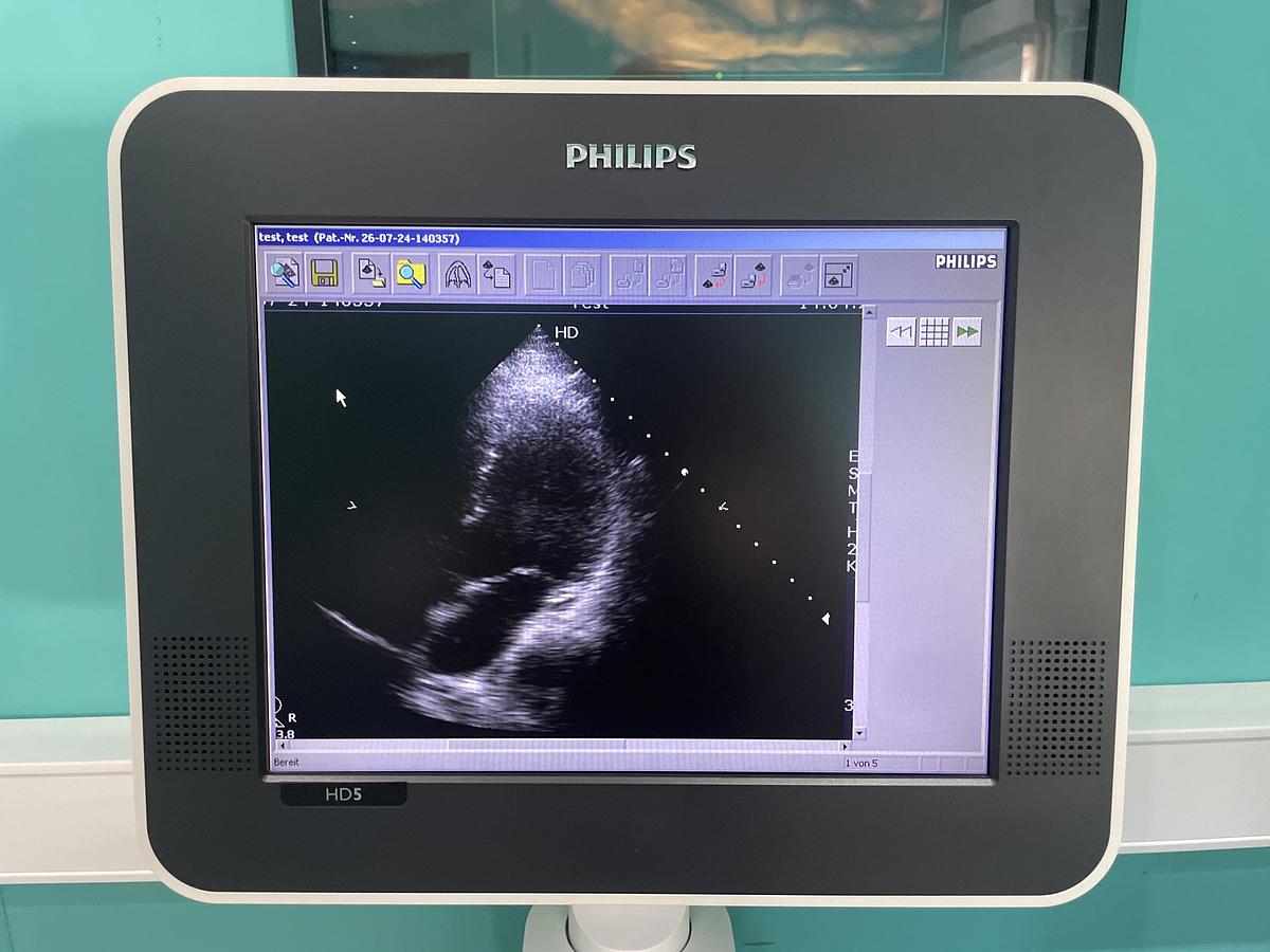 Gebraucht Philips HD5 Ultraschallgerät mit zwei Sonden und Drucker