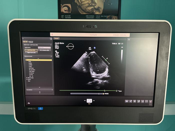 Used Philips EPIQ 5G Ultraschallgerät mit zwei Sonden