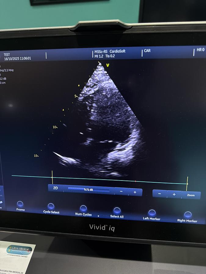 Gebraucht GE M5Sc-RS Kardio Ultraschallsonde