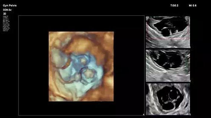 Philips Affiniti 70 Farbdoppler Ultraschallgerät