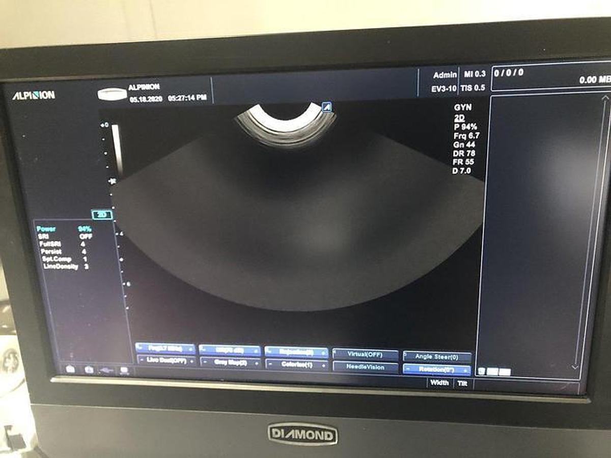 Gebraucht Alpinion EV3-10 Endovaginal Ultraschallsonde