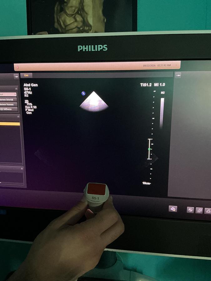Gebraucht Philips S5-1 Kardio Ultraschallsonde