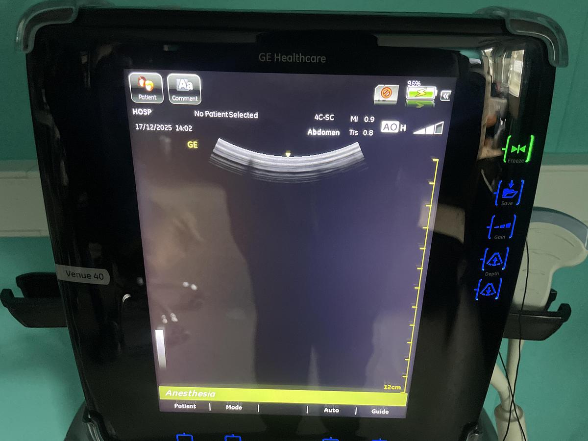 Gebraucht GE Venue 40 Ultraschallgerät mit Konvex Sonde