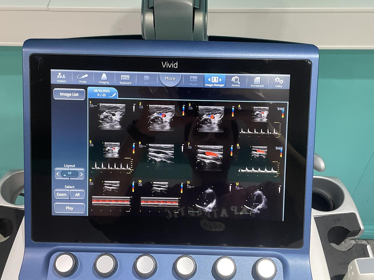 Gebraucht GE Vivid S70 Ultraschallgerät mit zwei Sonden