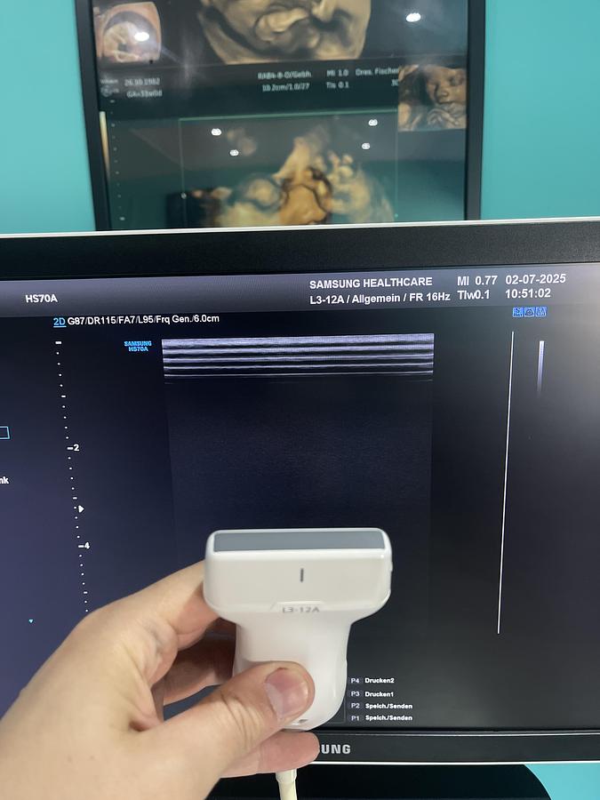 Gebraucht Samsung HS70A Ultraschallgerät mit drei Sonden