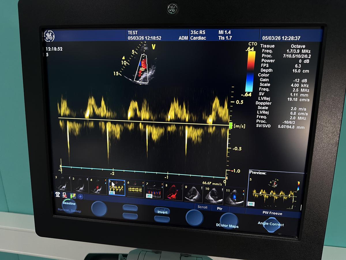 Gebraucht GE Vivid S6 Ultraschallgerät mit 3Sc-RS kardio Sonde