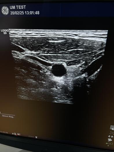 Gebraucht GE L11-D Linear Ultraschallsonde  