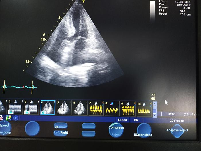 Gebraucht GE Vivid S5 Ultraschallgerät