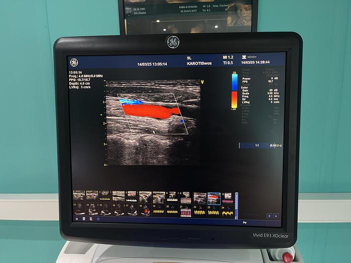 Gebraucht GE Vivid E9 XDclear Ultraschallgerät mit zwei Sonden #2015 