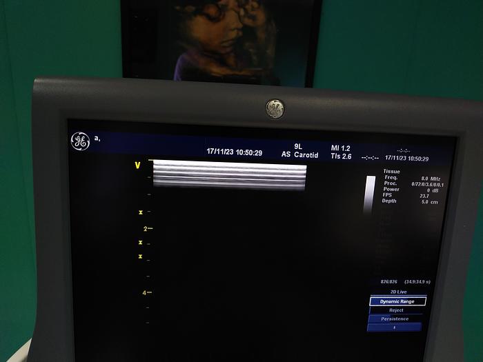 Gebraucht GE Vivid 7 Ultraschallgerät