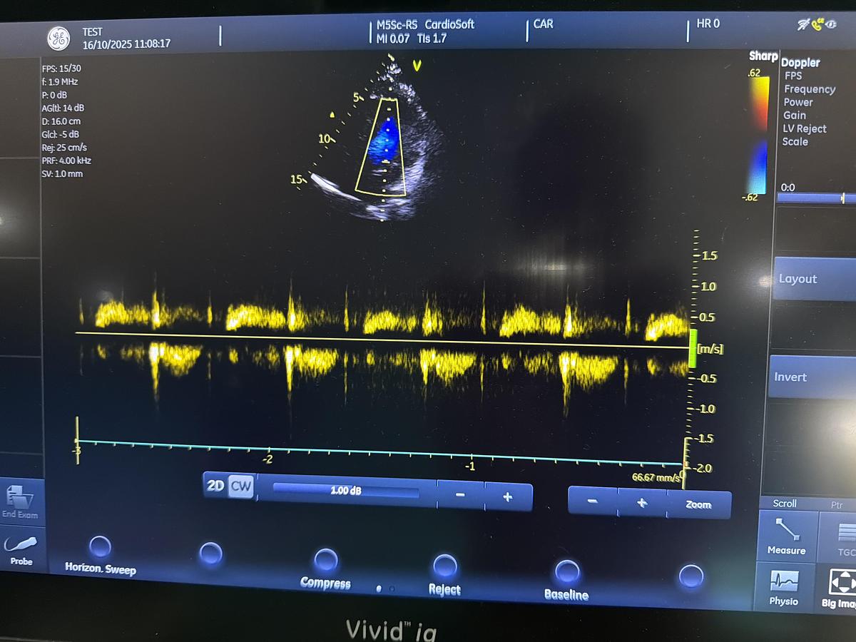 Gebraucht GE M5Sc-RS Kardio Ultraschallsonde