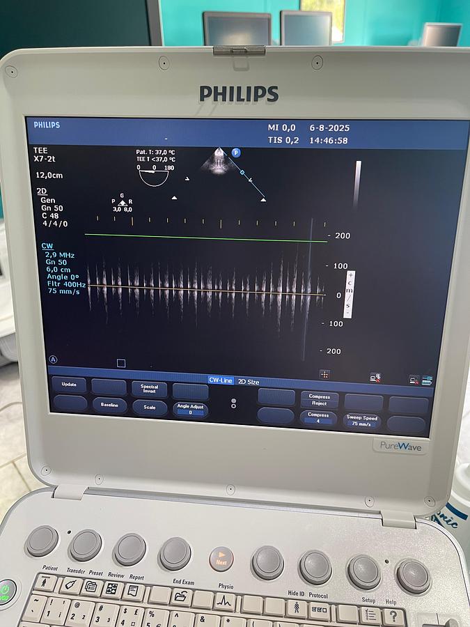 Gebraucht Philips X7-2t TEE Sonde
