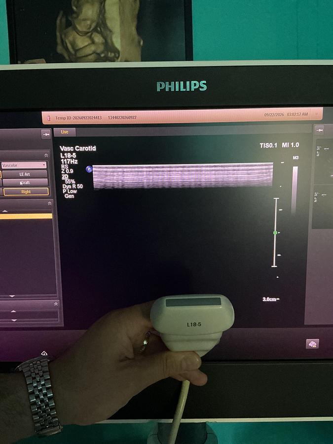 Gebraucht Philips L18-5 Linear Ultraschallsonde