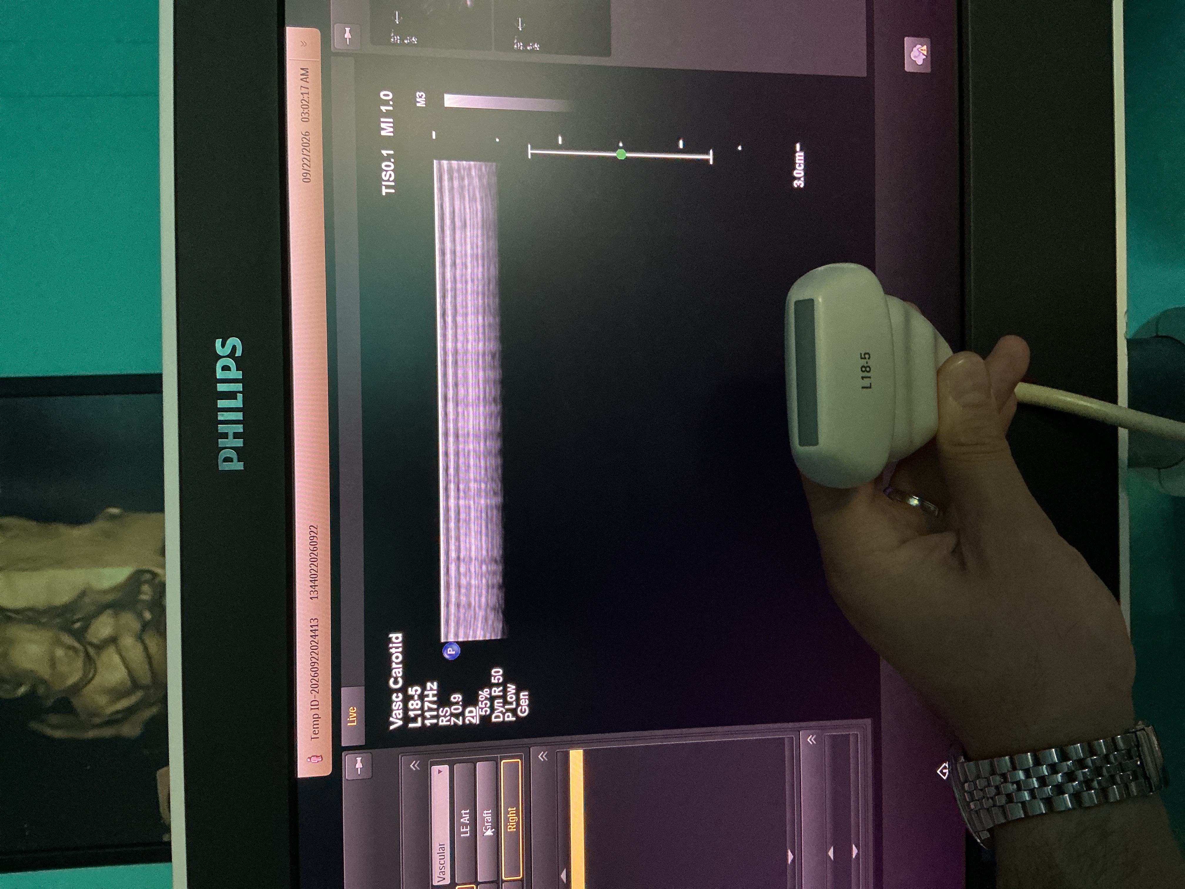 Gebraucht Philips L18-5 Linear Ultraschallsonde