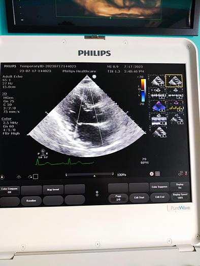 Gebraucht Philips CX50 Ultrasound with S5-1 and Trolly