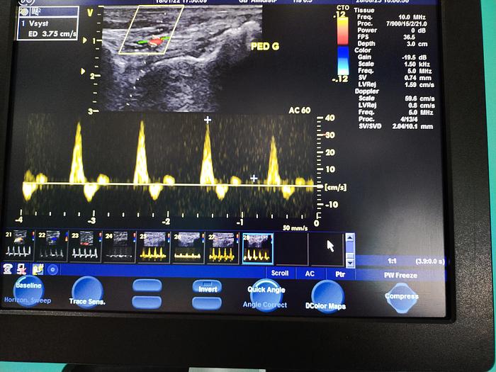 Gebraucht GE Vivid S5 Ultraschallgerät