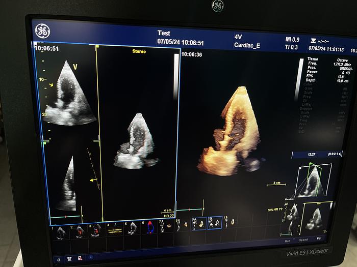 Gebraucht GE Vivid E9 XDClear Ultraschallgerät mit 2 Sonden