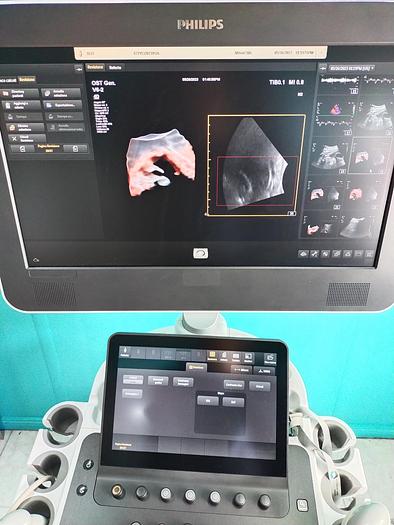 Gebraucht Philips V6-2  3D/4D  Volumen Ultraschallsonde