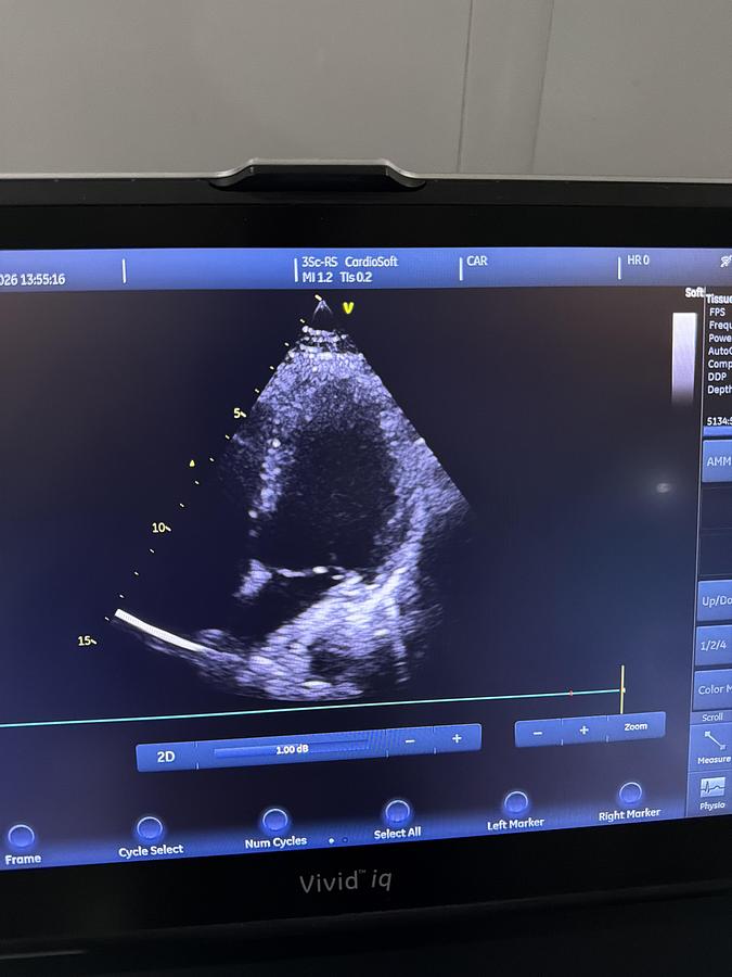 Gebraucht GE 3SC-RS Kardio Ultraschallsonde
