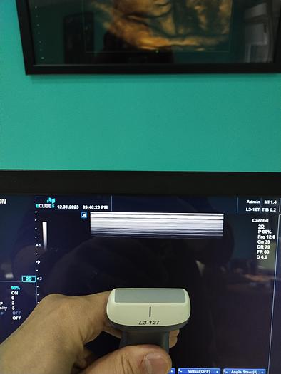 Gebraucht Alpinion ECUBE 5 Flachbildschirm-Ultraschallgerät inkl. 2 sonden Ultrasound