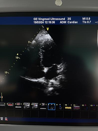 Gebraucht GE 3S Sektor Ultraschallsonde
