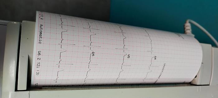 Gebraucht GE MAC 1200 ST EKG-Gerät