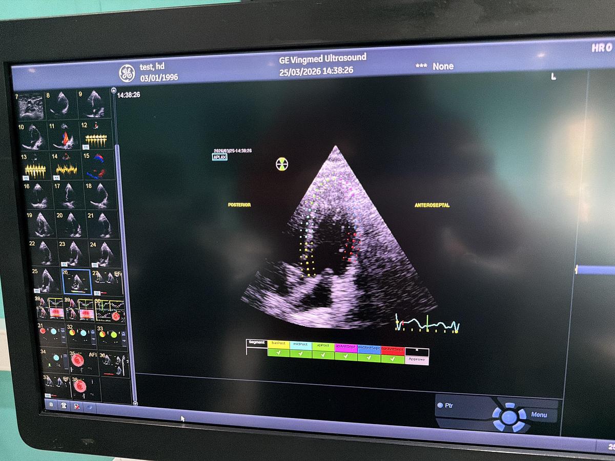 Gebraucht GE Vivid E95 v202 Ultraschallgerät mit zwei Sonden 