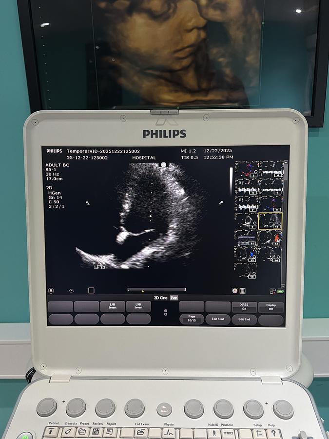 Gebraucht Philips CX50 SW 5Ultraschallgerät mit S5-1 Kardiosonde
