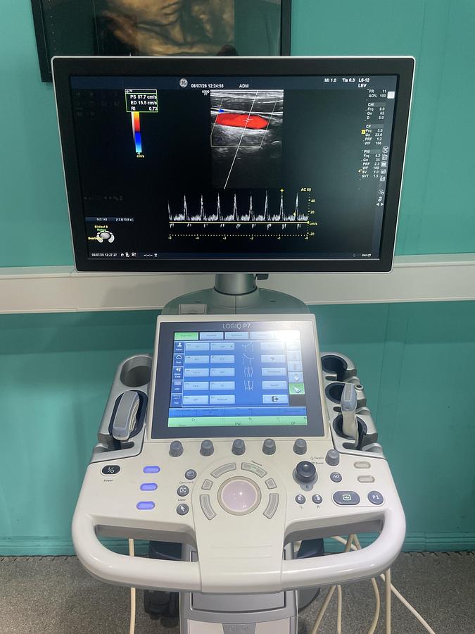 Gebraucht GE LOGIQ P7 Ultraschallgerät mit zwei Sonden
