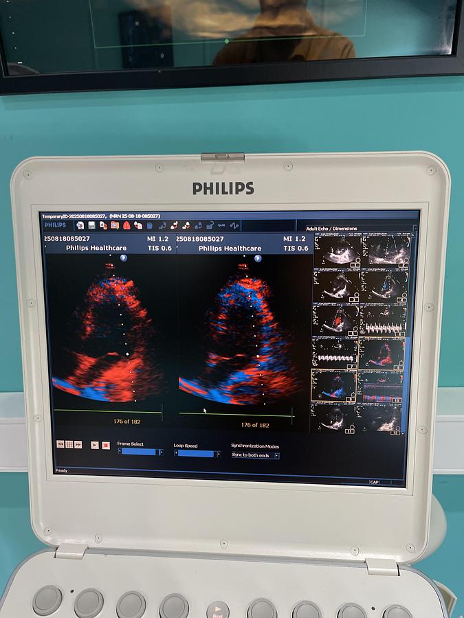 Gebraucht Philips CX50 Ultraschallgerät mit S5-1 Kardiosonde