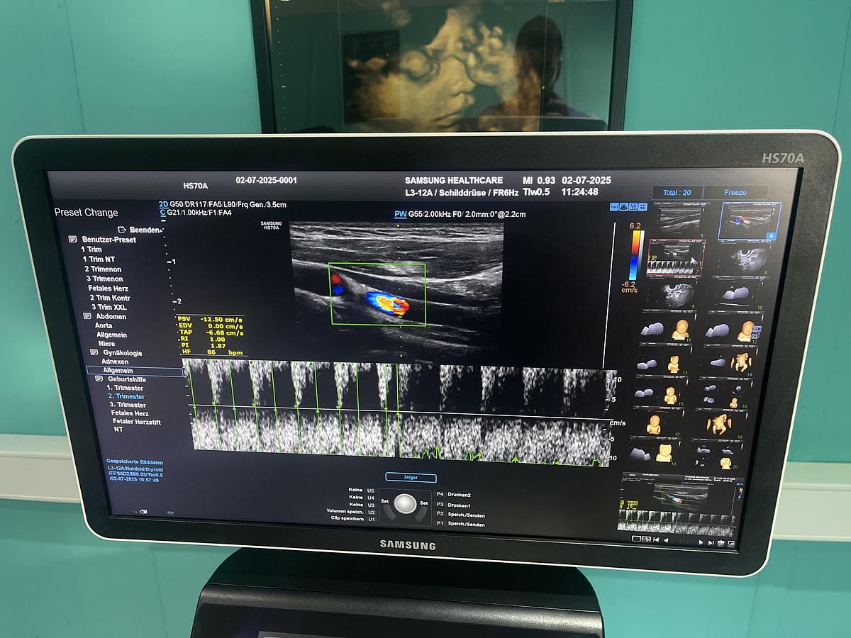 Gebraucht Samsung HS70A Ultraschallgerät mit drei Sonden