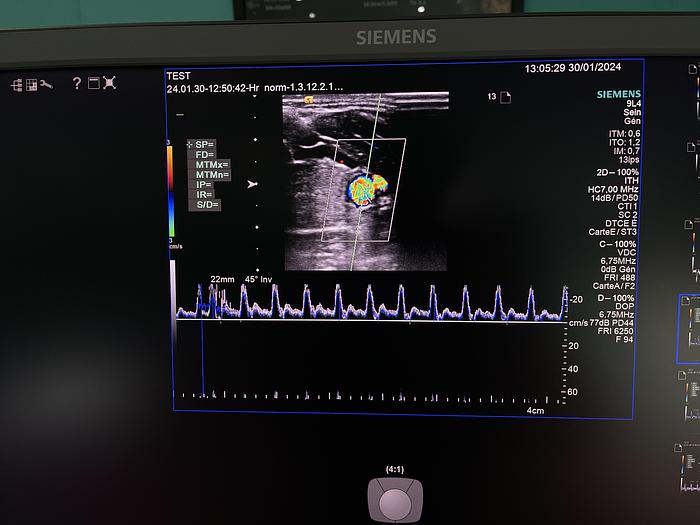 Gebraucht HELX Evoulution Acusion S2000 von Siemens Ultraschall Gerät mit drei Sonden
